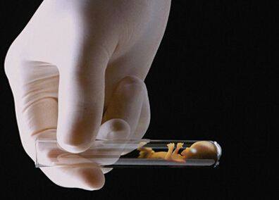 案例
